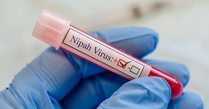 Nipah: como surgiu o vírus e como é a forma de transmissão