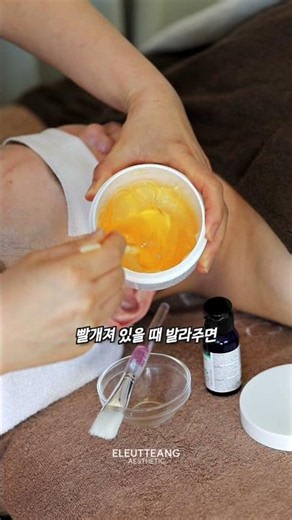압출 후 붉어진 피부에 딱! 에스테틱 진정 비법 | 에르떼앙 PICK