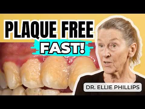 Get Rid of Plaque in 3 Months