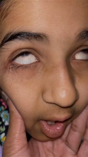 Phone side effects 😱 #minivlog #dailyvlog #familyvlog #ytshorts #shortvideo #shortsviral