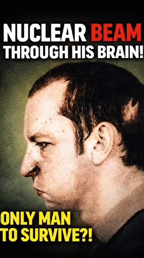 Factifiers on Instagram: "Anatoli Bugorski was a physicist working at a particle accelerator in the Soviet Union in 1978. During an accident, he accidentally placed his head in the path of a high-energy proton beam while the machine was operating. The beam passed straight through his skull. Bugorski did not die—he remained conscious and felt a flash “brighter than a thousand suns,” but no pain. The accident caused permanent nerve damage, paralysis on one side of his face, and seizures later in l