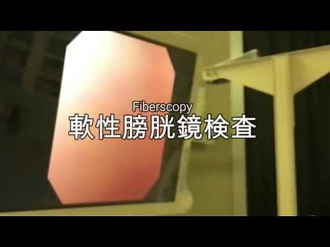 軟性膀胱鏡検査 Fiberscopy 20171222