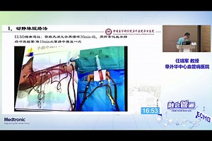 ECMO撤机评估、方法、流程 任培军