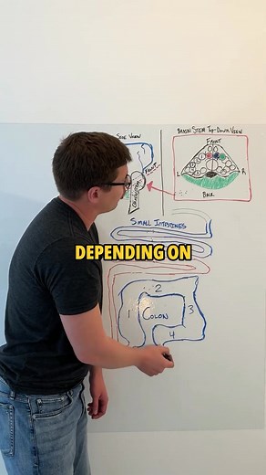 5.2K views · 15 reactions | C. Diff Will Never Go Away If You Don’t Know This!!! | Heal Your Gut Guy | Facebook