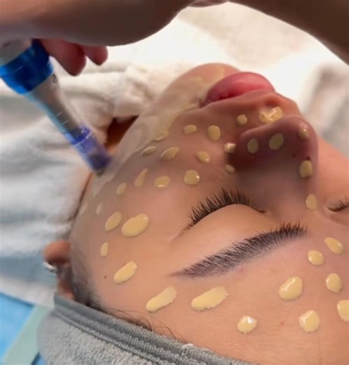 Nano Glow Perfect Tone Da căng mịn, bật tone từ lần đầu #NanoGlow | Phúc Nguyễn