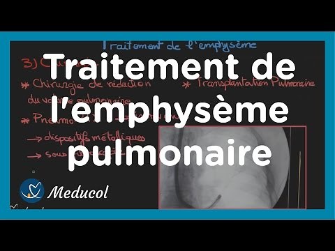 Pulmonary Emphysema: Treatment of Emphysema