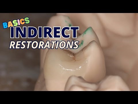 Basics of Indirect Restorations Part 1 - Decision Making - PS006