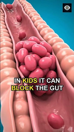 What Happens If You Swallow Gum 😱