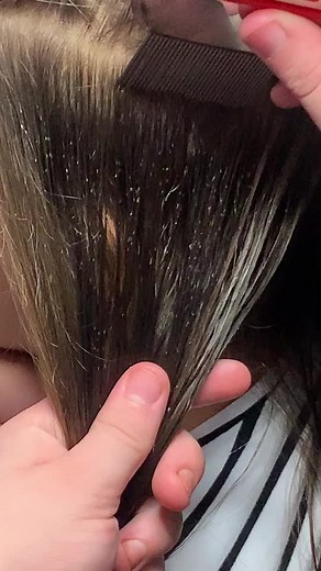 It’s amazing the difference a great nit comb can make. #nits #lice #ew #satisfying #sleeptight #sandman