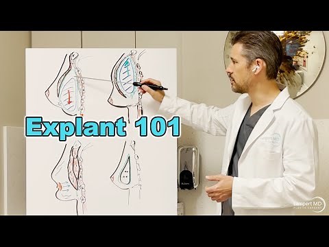 Explant 101: Breast Implant Removal Basic Concepts