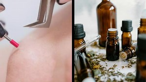 De ce apare la femei par pe fata? Ce boli ascunde acest simptom si cum poti trata si scapa de aceasta neplacere