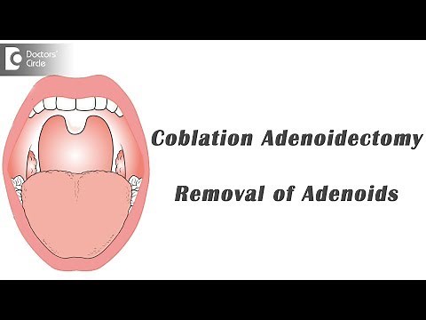 Adenoidectomy