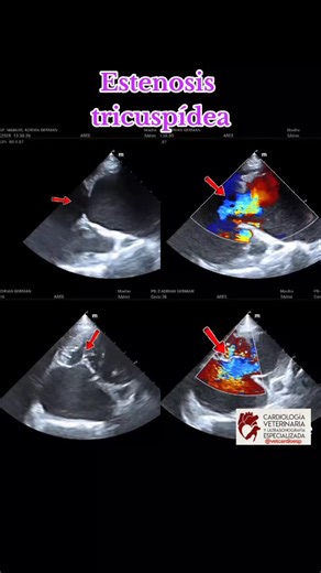 La estenosis tricuspídea en perros es una enfermedad cardíaca congénita que afecta la válvula tricúspide causando estrechez, ubicada entre en atrio derecho y el ventrículo derecho del corazón. La estenosis tricuspídea es causada por una malformación congénita lo que significa que los perros nacen con esta condición. Algunas razas, como el Labrador Retriever, Pastor Alemán, Golden Retriever y Gran Danés, son más propensas a desarrollar esta enfermedad. La estenosis tricuspídea es una enfermedad r