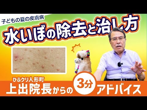 How to remove and treat warts [3-minute advice from Director Kamiide ​​of Hifukuri Ningyocho] Chi...