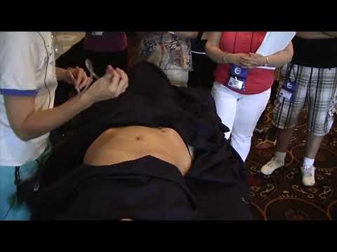 Addressing Abdominal Issues with ACE Massage Cupping Therapy - Cupping Therapy Workshop Demo Part 13