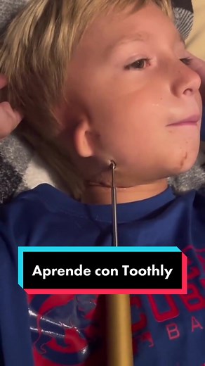 Aprende sobre el distractor mandibular y su uso en odontología