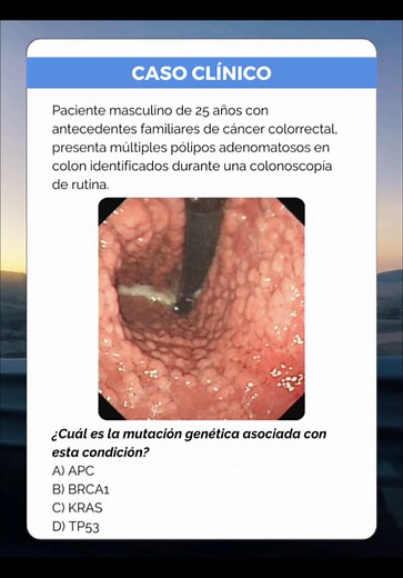 Poliposis Adenomatosa Familiar: Causas y Tratamiento
