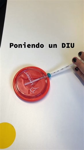 ¿Cómo se coloca un DIU en el utero de una mujer? #mujer #anticoncepcion #anticonceptivas #DIU #mirena #kyleena #utero #medicina #practicas #granada