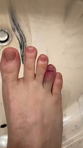 Stubbed my toe last night. This is what it looked like today.