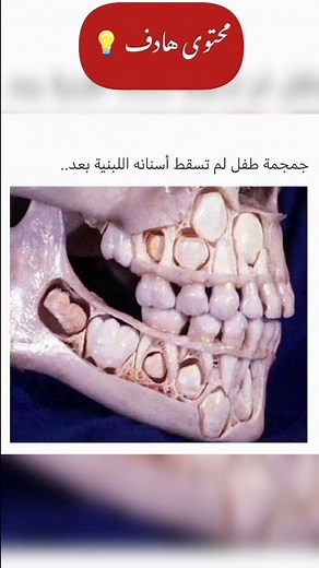 هذه هي جمجمة طفل لم تسقط أسنانه اللبنية بعد | صورة رائعة #shorts 🧠📖📚💡