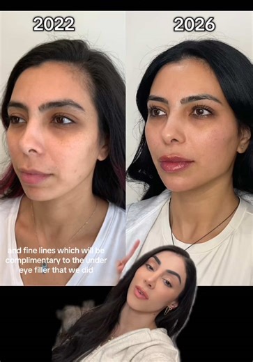 Four Year Glow Up Breakdown: Transformative Aesthetic Journey