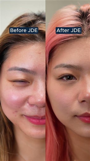 Hi, this is Dr. Yoko.