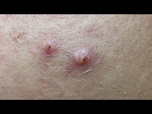 Satisfying Relaxing with Sac Dep Spa Video (#227)