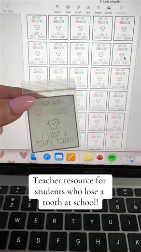 Adorable Tooth Bags for Kids - Teacher Resource for Lost Teeth