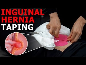 Easy Support for Inguinal Hernia: A Physical Therapist’s Expert Guide