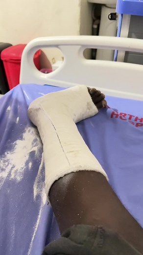 Preparing for Cast Removal in Orthopedic Surgery