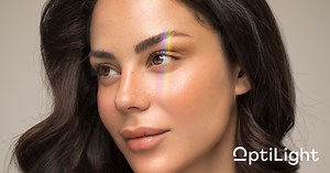 What Is the OptiLight by Lumenis & How Can It Manage Your Dry Eye? | Mann Eye