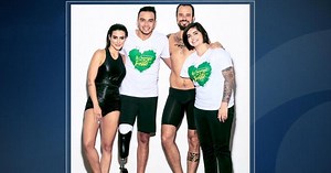 Vogue Brazil edits models to look disabled