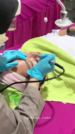 Microdermabrasion Treatment