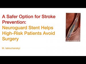 A Safer Option for Stroke Prevention: Neuroguard Stent Helps High-Risk Patients Avoid Surgery