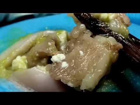 DR LEE’S ULTIMATE ZITPOPPER/ with Tweezer 角栓除去 MrPopZit Enilsa pimple zit pops Podologia 0816 4980