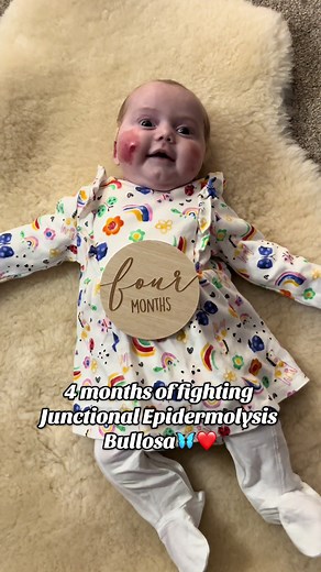 Darcie's Journey with Junctional Epidermolysis Bullosa