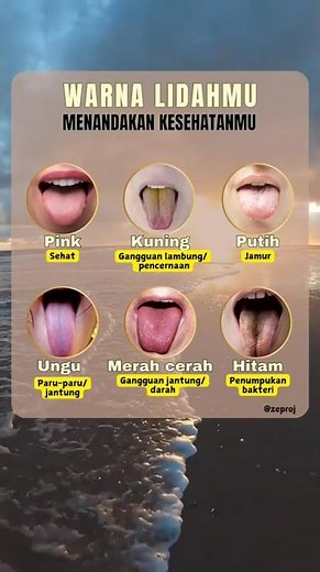 Mengenali gangguan kesehatan badan melalui warna lidah #infokesehatan #lidah #asamlambung #kesehatan