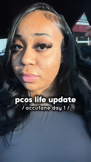 call me Candace 👩🏽‍🔬 on Instagram: "PCOS life update - starting my accutane journey today! So far I just feel really sleepy today. 😭 I’ll check in next week lol"