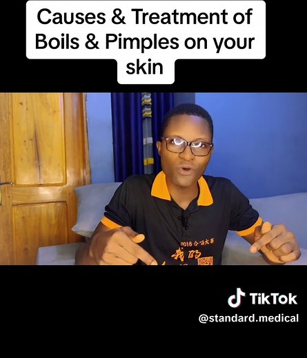 Causes & Treatment of Boils and pimples on your skin especially when you barb #CapCut #health #pimples #boils #tiktoknigerianigeria🇳🇬