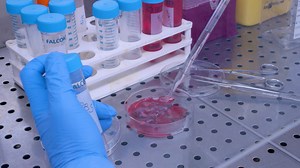 Microvascular and Macrovascular Endothelial Cell Isolation and Purification from Lung-Derived Samples