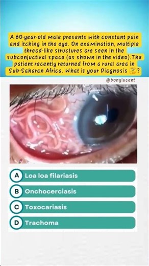 What's Your Diagnosis 🤔Clinical Series -01 🩺 #clinic #medicalshorts #medicalcollege #mbbs #bhms