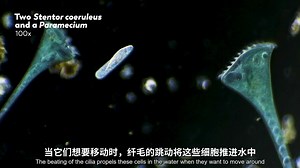 超级单细胞生物：Stentors