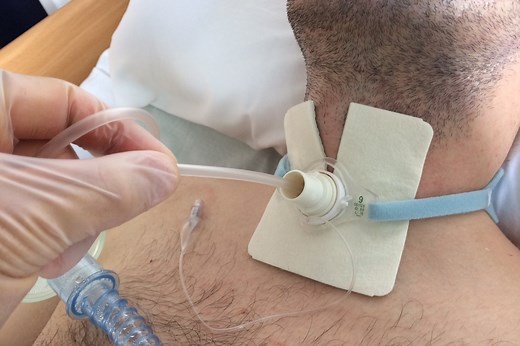 Difference between tracheotomy and tracheostomy | Emergency Live