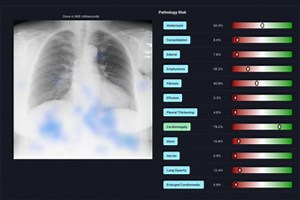 X-RAI: Your Personal Radiologist Assistant