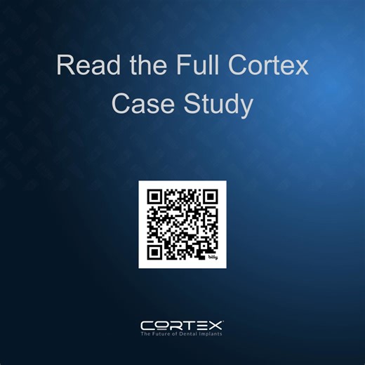 This clinical report by Dr. Marco Berardini, DDS documents an upper-left canine extraction implant placement case using Cortex DYNAMIX, supported with step-by-step photos and X-rays. Key clinical takeaways: • Clear drilling flow (pilot → 2.8 mm → 2.8 mm → 3.2 mm) with angulation verification using parallelism pins • Practical site management: bone chips collected during drilling and used as part of defect management • Controlled insertion with strong primary stability About DYNAMIX: DYNAMIX feat