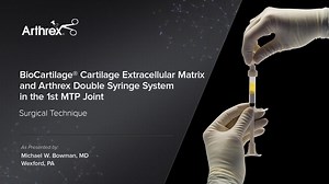 BioCartilage®  Cartilage Extracellular Matrix and Arthrex Double Syringe System in the 1st MTP Joint