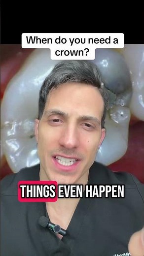 WHEN do you NEED a crown for your teeth?