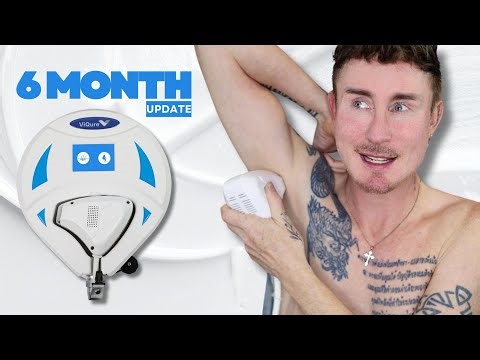 ViQure EpiPro 6-Month Laser Hair Removal Update: The Ultimate Home Hair Removal Machine