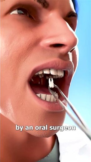Teeth On The Roof of Your Mouth¿ 😨 Surgeon Reacts