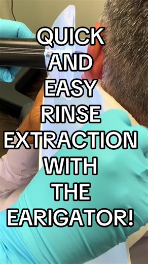 Earwax Removal Satisfaction: Quick and Easy Extraction